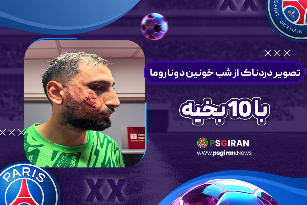 تصویر دردناک از شب خونین دوناروما با ۱۰ بخیه!