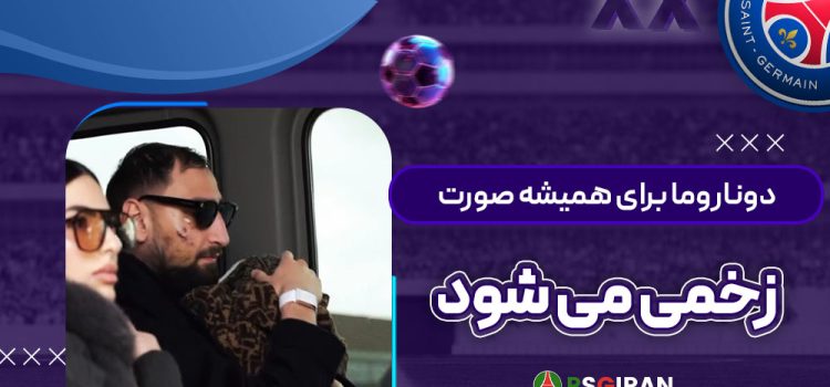 دوناروما برای همیشه صورت‌زخمی می‌شود! (عکس)‏