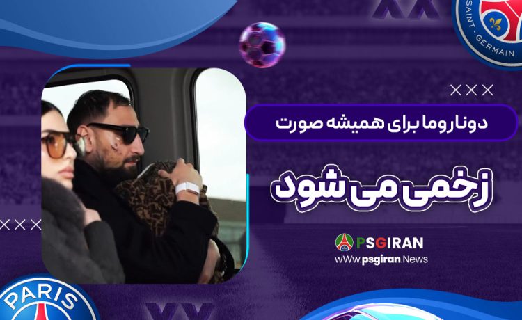 دوناروما برای همیشه صورت‌زخمی می‌شود! (عکس)‏