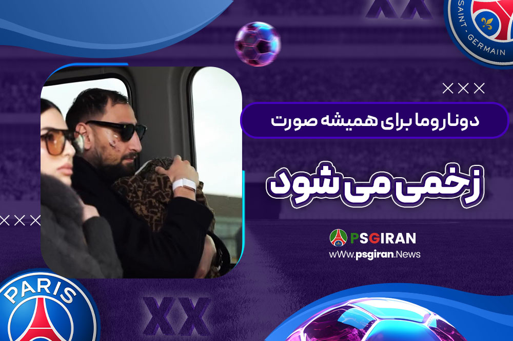 دوناروما برای همیشه صورت‌زخمی می‌شود! (عکس)‏